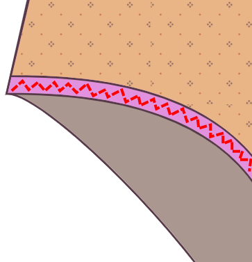 Sew elastic to the outside of the garment